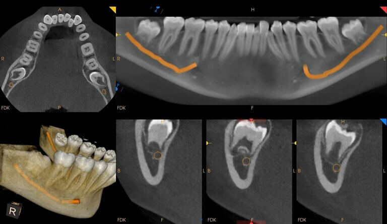 CBCT (3D Dental Imaging)