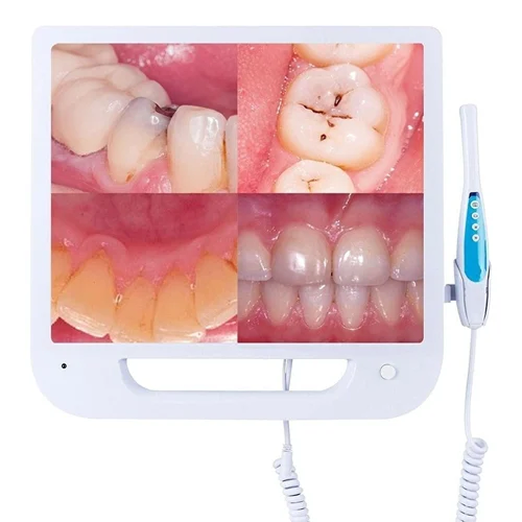 Intra Oral Camera